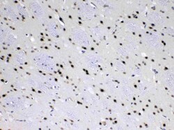 Invitrogen MED18 Polyclonal Antibody 100 &mu;g | Buy Online | Invitrogen&trade; | Fisher Scientific