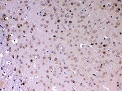 Invitrogen MED18 Polyclonal Antibody 100 &mu;g | Buy Online | Invitrogen&trade; | Fisher Scientific