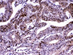 Invitrogen MED18 Polyclonal Antibody 100 &mu;g | Buy Online | Invitrogen&trade; | Fisher Scientific