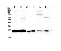 Invitrogen MED18 Polyclonal Antibody 100 &mu;g | Buy Online | Invitrogen&trade; | Fisher Scientific