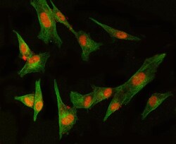 Invitrogen MED8 Polyclonal Antibody 100 &mu;g | Buy Online | Invitrogen&trade; | Fisher Scientific
