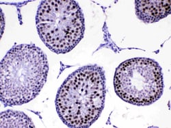 Invitrogen MED8 Polyclonal Antibody 100 &mu;g | Buy Online | Invitrogen&trade; | Fisher Scientific