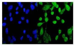 Invitrogen MED9 Polyclonal Antibody 100 &mu;g; Unconjugated:Antibodies,