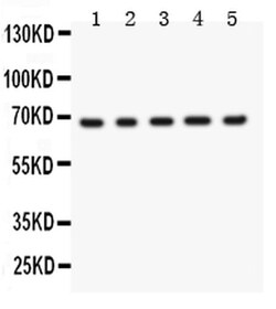 Invitrogen Menin Polyclonal Antibody 100 &mu;g | Buy Online | Invitrogen&trade; | Fisher Scientific