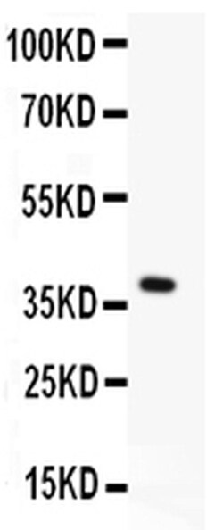 Invitrogen Menin Polyclonal Antibody 100 &mu;g | Buy Online | Invitrogen&trade; | Fisher Scientific
