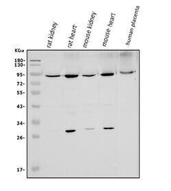Invitrogen MFN1 Polyclonal Antibody 100 &mu;g | Buy Online | Invitrogen&trade; | Fisher Scientific