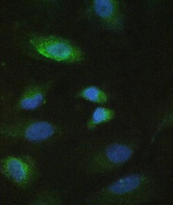 Invitrogen MMP10 Polyclonal Antibody 100 &mu;g; Unconjugated:Antibodies,