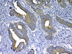 Invitrogen MMP10 Polyclonal Antibody 100 &mu;g; Unconjugated:Antibodies,