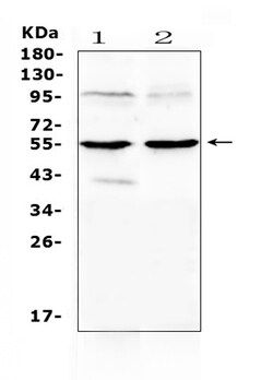 Invitrogen MMP10 Polyclonal Antibody 100 &mu;g; Unconjugated:Antibodies,