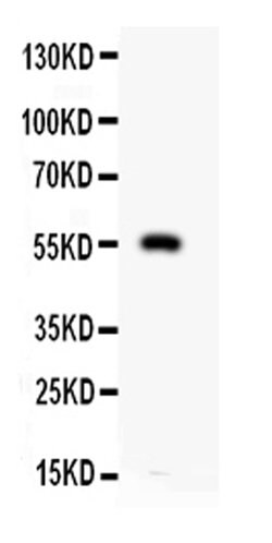Invitrogen MMP12 Polyclonal Antibody 100 &mu;g; Unconjugated:Antibodies,