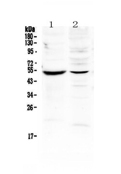 Invitrogen MMP16 Polyclonal Antibody 100 &mu;g | Buy Online | Invitrogen&trade; | Fisher Scientific