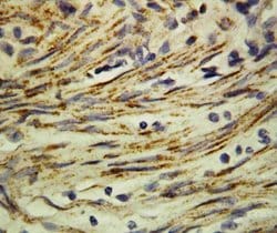 Invitrogen MMP16 Polyclonal Antibody 100 &mu;g; Unconjugated:Antibodies,