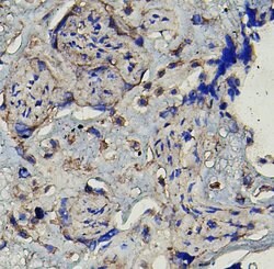 Invitrogen MMP16 Polyclonal Antibody 100 &mu;g; Unconjugated:Antibodies,