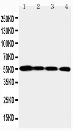 Invitrogen MMP24 Polyclonal Antibody 100 &mu;g | Buy Online | Invitrogen&trade; | Fisher Scientific