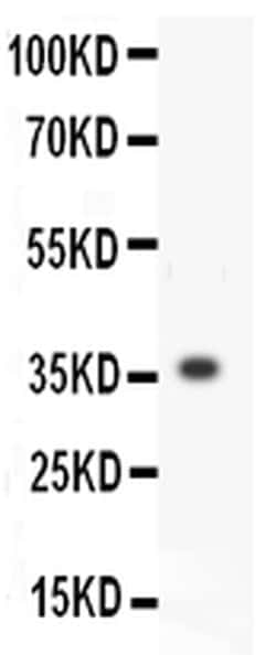 Invitrogen MMP3 Polyclonal Antibody 100 &mu;g; Unconjugated:Antibodies,