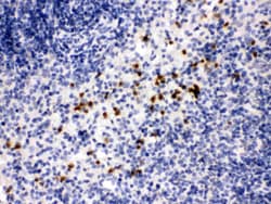 Invitrogen MMP8 Polyclonal Antibody 100 &mu;g; Unconjugated:Antibodies,