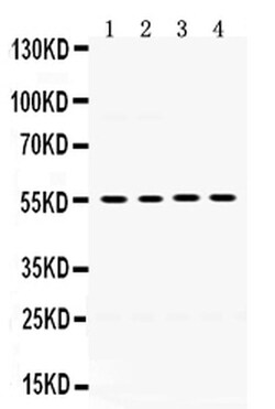 Invitrogen MMP8 Polyclonal Antibody 100 &mu;g; Unconjugated:Antibodies,