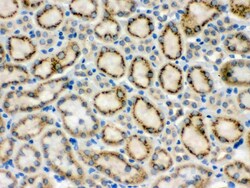 Invitrogen MMP9 Polyclonal Antibody 100 &mu;g; Unconjugated:Antibodies,