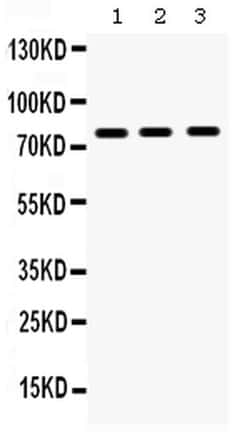 Invitrogen MMP9 Polyclonal Antibody 100 &mu;g; Unconjugated:Antibodies,