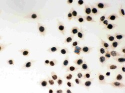 Invitrogen MSH2 Polyclonal Antibody 100 &mu;g; Unconjugated:Antibodies,