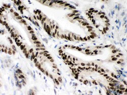 Invitrogen MSH2 Polyclonal Antibody 100 &mu;g; Unconjugated:Antibodies,