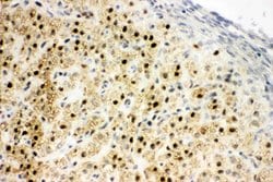 Invitrogen MTA1 Polyclonal Antibody 100 &mu;g; Unconjugated:Antibodies,
