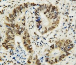 Invitrogen MTA1 Polyclonal Antibody 100 &mu;g; Unconjugated:Antibodies,