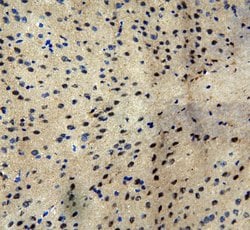 Invitrogen MTA1 Polyclonal Antibody 100 &mu;g; Unconjugated:Antibodies,