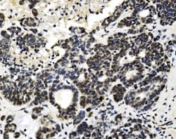Invitrogen MTA1 Polyclonal Antibody 100 &mu;g; Unconjugated:Antibodies,