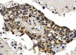 Invitrogen MTA1 Polyclonal Antibody 100 &mu;g; Unconjugated:Antibodies,