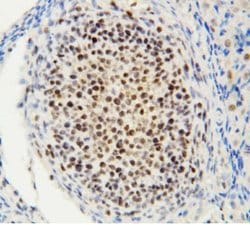 Invitrogen MTA1 Polyclonal Antibody 100 &mu;g; Unconjugated:Antibodies,