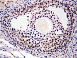 Invitrogen MTA1 Polyclonal Antibody 100 &mu;g; Unconjugated:Antibodies,