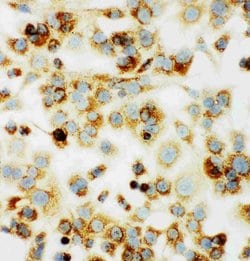 Invitrogen MTCO1 Polyclonal Antibody 100 &mu;g; Unconjugated:Antibodies,