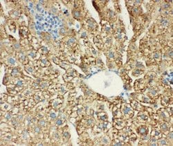 Invitrogen MTCO1 Polyclonal Antibody 100 &mu;g; Unconjugated:Antibodies,