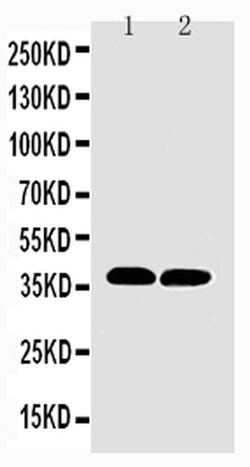 Invitrogen MTCO1 Polyclonal Antibody 100 &mu;g; Unconjugated:Antibodies,