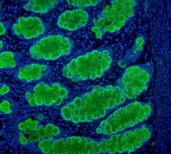 Invitrogen MUC2 Polyclonal Antibody 100 &mu;g; Unconjugated:Antibodies,