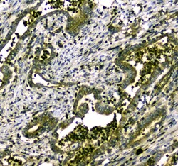 Invitrogen MYBPC3 Polyclonal Antibody 100 &mu;g | Buy Online | Invitrogen&trade; | Fisher Scientific
