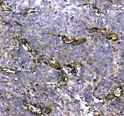 Invitrogen MYBPC3 Polyclonal Antibody 100 &mu;g | Buy Online | Invitrogen&trade; | Fisher Scientific