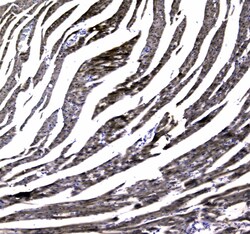 Invitrogen MYBPC3 Polyclonal Antibody 100 &mu;g | Buy Online | Invitrogen&trade; | Fisher Scientific