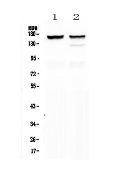 Invitrogen MYBPC3 Polyclonal Antibody 100 &mu;g | Buy Online | Invitrogen&trade; | Fisher Scientific