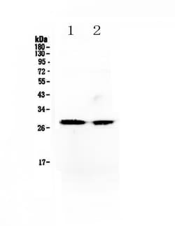 Invitrogen MYF5 Polyclonal Antibody 100 &mu;g; Unconjugated:Antibodies,