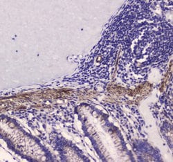 Invitrogen MYLK Polyclonal Antibody 100 &mu;g; Unconjugated:Antibodies,