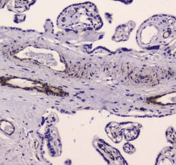 Invitrogen MYLK Polyclonal Antibody 100 &mu;g; Unconjugated:Antibodies,