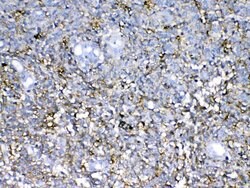 Invitrogen Neurocan Polyclonal Antibody 100 &mu;g; Unconjugated:Antibodies,