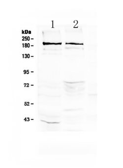 Invitrogen Neurocan Polyclonal Antibody 100 &mu;g; Unconjugated:Antibodies,