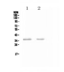 Invitrogen NKp46 (CD335) Polyclonal Antibody 100 &mu;g; Unconjugated:Antibodies,