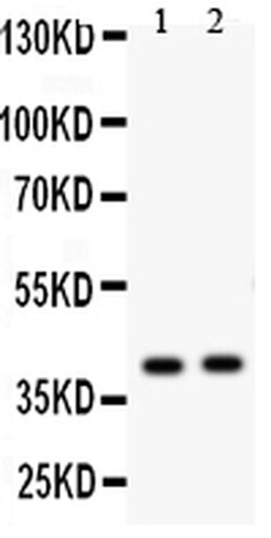 Invitrogen NDRG2 Polyclonal Antibody 100 &mu;g; Unconjugated:Antibodies,