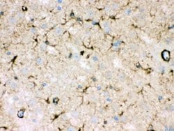 Invitrogen NDRG2 Polyclonal Antibody 100 &mu;g; Unconjugated:Antibodies,