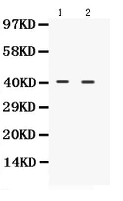 Invitrogen NDRG2 Polyclonal Antibody 100 &mu;g; Unconjugated:Antibodies,