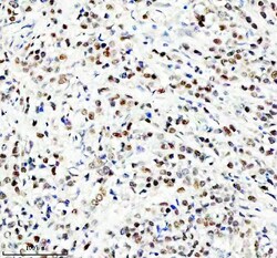 Invitrogen HEF1 Polyclonal Antibody 100 &mu;g | Buy Online | Invitrogen&trade; | Fisher Scientific